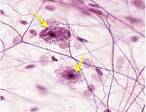 Histo - Connective Tissue & Blood Flashcards | Quizlet