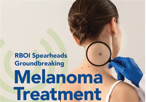 RBOI Goundbreaking Melanoma Treatment - Robert Boissoneault Oncology Institute