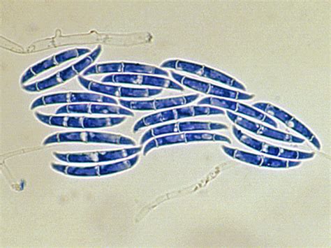 Fusarium | Mycology | University of Adelaide