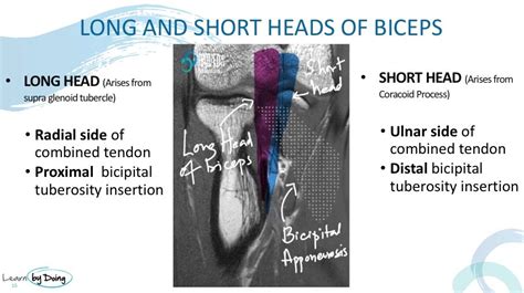 DISTAL BICEPS TENDON: DOUBLE TROUBLE - Radedasia