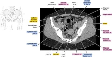 Why Ct Scan Abdomen Pelvis