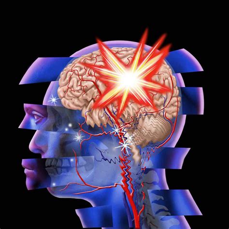 Traumatic Brain Injury & Drugs - Victory Addiction Recovery Center