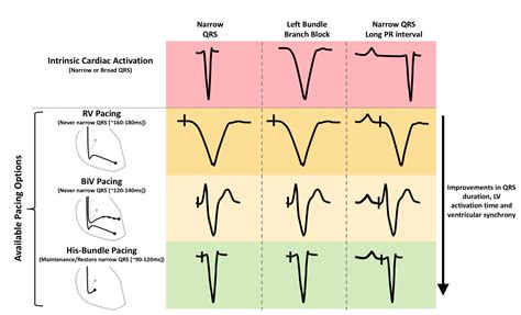 Br J Cardiol 2018.