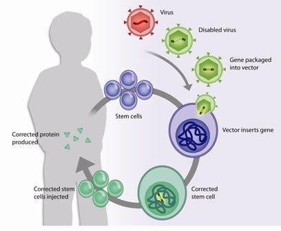 A new start for gene therapy for 'bubble boy' disease: First U.S ...