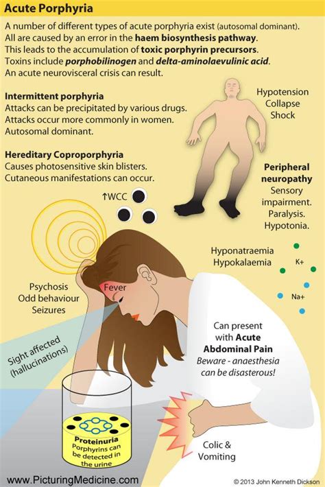 Porphyria Attack Symptoms