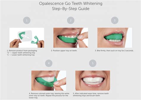 How to Use Opalescence Tooth Whitening - Baird Orthodontics | Pleasanton CA