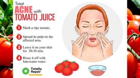 Check Out Benefits Of Tomato For Your Face and Skin - Totally Repair