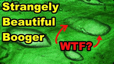 THE MOST BEAUTIFUL BOOGER UNDER A MICROSCOPE. DISGUSTING AND STRANGE! - YouTube