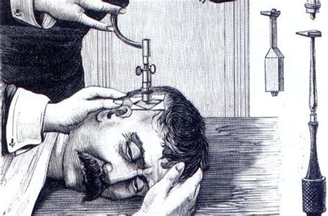 Shocking Stories of Trepanation (Photos)