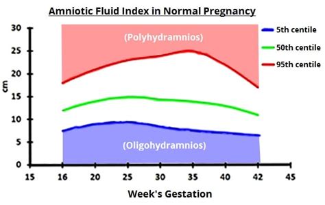 Oligohidramnios - Causas - Tratamiento - Pronóstico | IWOFR