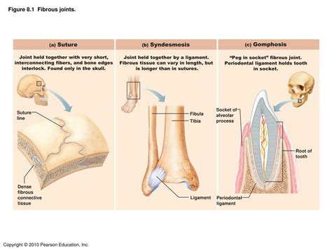 PPT - Joints PowerPoint Presentation, free download - ID:3118287