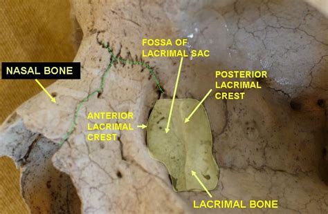 Lacrimal Bone - The Definitive Guide | Biology Dictionary