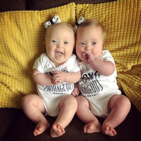 These adorable identical twins with Down Syndrome will brighten up your day