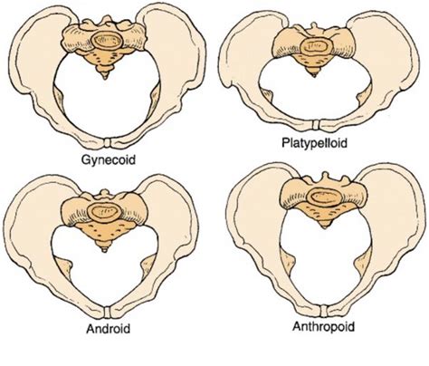 How Child-Bearing Hips Affect Delivery With 4 Other Important Factors! | SLECK