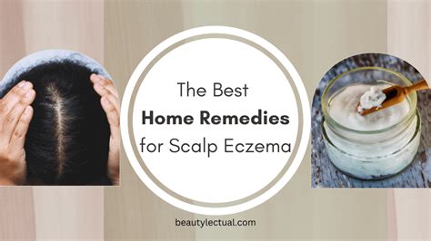 Scalp Eczema Treatment Home Remedies: Say Goodbye to Itchy Scalp With ...