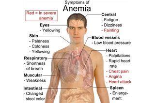 Reasons Ferritin Would Be Abnormally Low | eHow | Chest pain, Health and wellbeing, Medical ...