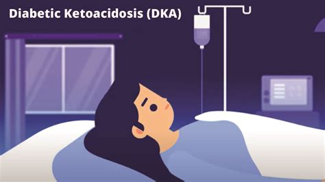 A case of Diabetic Ketoacidosis(DKA): Symptoms, Diagnosis & Management ...