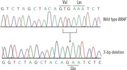 Direct sequencing of exon 15 of the BRAF gene after MEMO-PCR. Top,... | Download Scientific Diagram