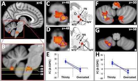 Brain regions showing increased functional connectivity with the aMCC... | Download Scientific ...