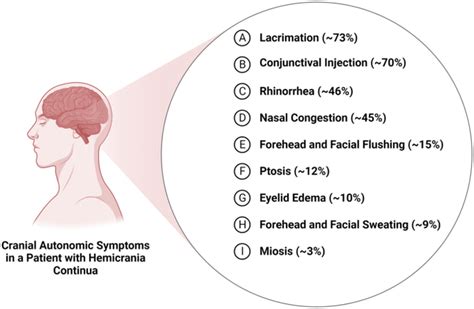 Symptoms of hemicrania continua - MEDizzy