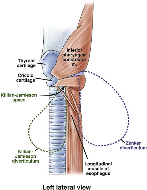 Figure 1 from Zenker's Diverticulum. | Semantic Scholar