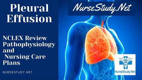 Pleural Effusion Nursing Diagnosis Interventions and Care Plans ...