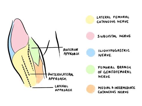 Evidence for Regional Anesthesia Blocks for Patients with Hip Fractures : WFSA - Resources