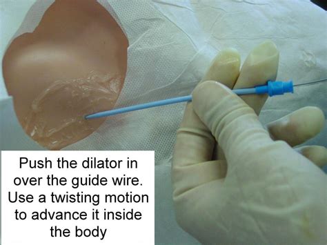 Clinical Notes: Central Line Placement: A Step-by-Step Procedure Guide with Photos