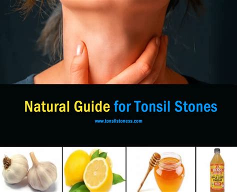 7 Natural Home Remedies to Cure Tonsil Stones [2022]