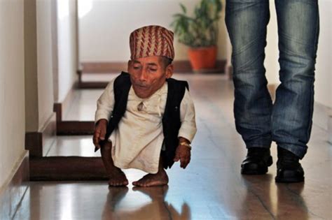 PICTURES - Primordial Dwarfism