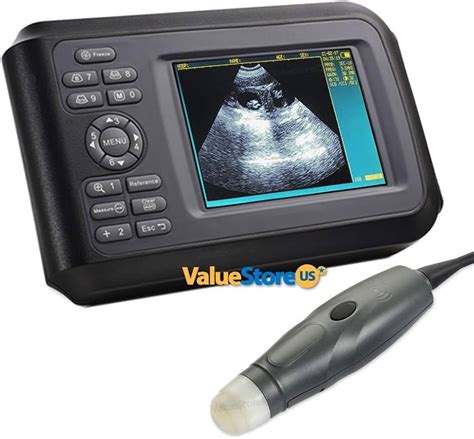 How Much Do Ultrasound Transducers Cost? A Comprehensive Price Guide