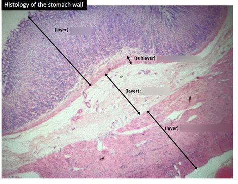 histology of the stomach wall Diagram | Quizlet