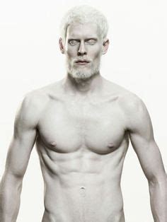 190 Albino People ideas | albino, albinism, people