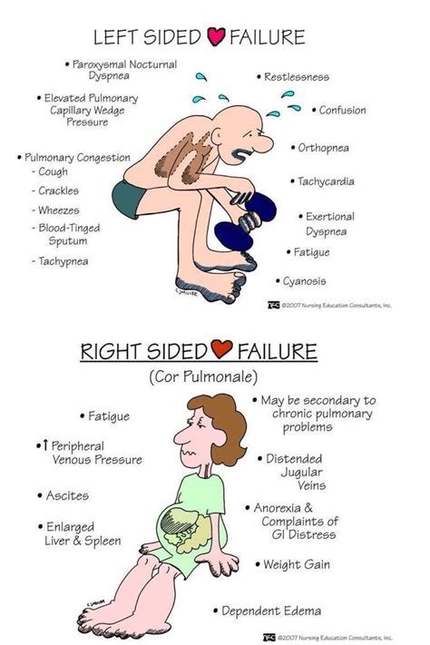 Left sided heart failure LVF and Right sides heart failure RVF #cardiac #cardiacfailure #lvf ...