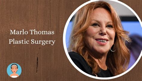 Marlo Thomas Plastic Surgery: What's the Real Story Behind Her Facelift?