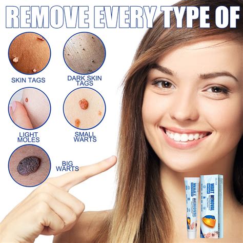 【EELHOE】Warts Remover Original Cream Skin Tag Remover Original Warts ...