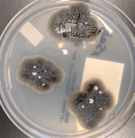 Figure-2-Fungal-culture-plate_5_17_2021_MN - Doctor Fungus