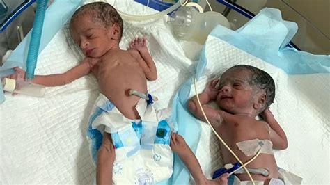 'World's oldest mom' gives birth to twins at age 74, hospital claims