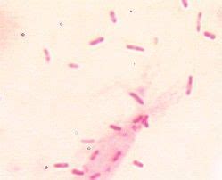 Serratia Marcescens Under Microscope