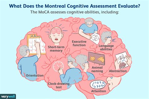 MoCA Test (Montreal Cognitive Assessment) for Dementia