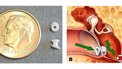 Expert advice on preventing, treating kids' ear infections