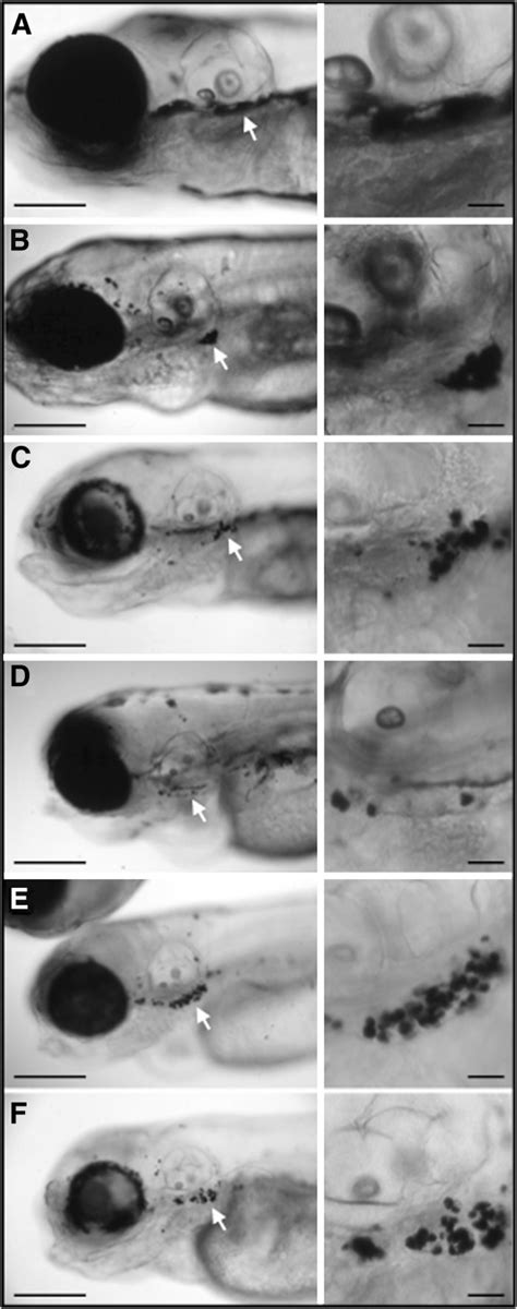 Lateral views from zebrafish insertional mutants for five V-ATPase... | Download Scientific Diagram