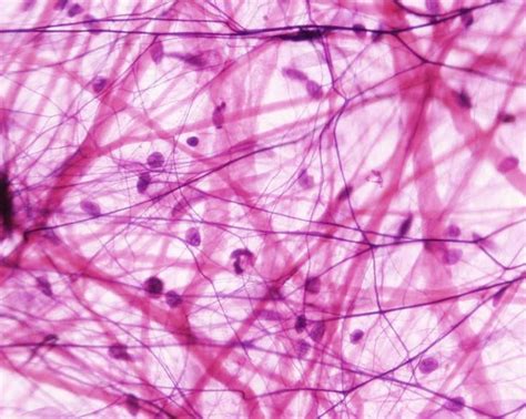 Inflammation of Connective Tissue | Loose connective tissue, Histology slides, Tissue types