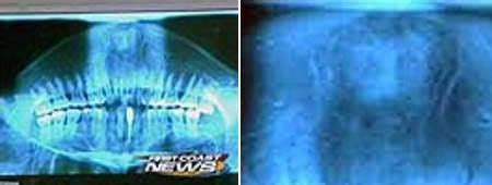 WEIRD NEWS: 12 Weird X-Rays