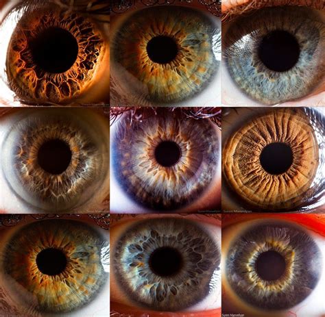 #iridology - different coloured eyes.. http://mywellbeingmagazine.com | Iridology, Iridology ...