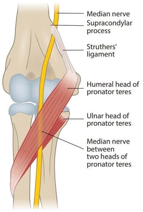 Median Nerve Palsy