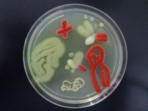 Morganella Morganii Colony Morphology on MacConkey Medium Archives ...