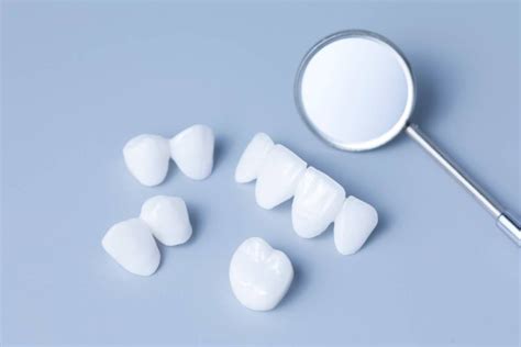 Avoiding Dental Bridge Problems - Valley Alder Family Dentistry