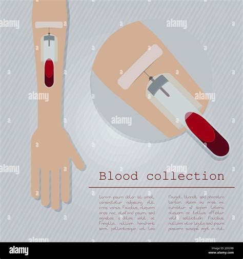 Venous blood collection Stock Vector Image & Art - Alamy