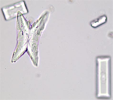 Struvite Crystalluria: Three Cases | Clinician's Brief